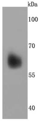 Western Blot: Perilipin Antibody (JM10-96) [NBP2-67037] - Analysis of Perilipin A on human liver cells lysates using anti-Perilipin A antibody at 1/500 dilution.