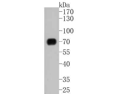 Western Blot: Perilipin Antibody (JM10-96) [NBP2-67037] - Western blot analysis of Perilipin on human liver tissue lysates. Proteins were transferred to a PVDF membrane and blocked with 5% BSA in PBS for 1 hour at room temperature. The primary antibody (1/500) was used in 5% BSA at room temperature for 2 hours. Goat Anti-Rabbit IgG - HRP Secondary Antibody (HA1001) at 1:5,000 dilution was used for 1 hour at room temperature.