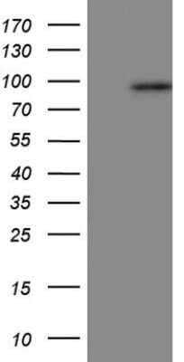 Western Blot: Periostin/OSF-2 Antibody (OTI2B2) - Azide and BSA Free [NBP2-73336] - Analysis of HEK293T cells were transfected with the pCMV6-ENTRY control (Left lane) or pCMV6-ENTRY Periostin.