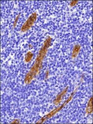Immunohistochemistry: Peripheral Node Addressin Antibody (MECA-79) - Low Endotoxin and Azide Free [NBP2-78790] - Analysis of FFPE human tonsil tissue section using Peripheral Node Addressin antibody (clone MECA-79R) at 1:100. The staining was developed with HRP-DAB detection method and the counterstaining was performed using hematoxylin. Image using the standard format of this product.