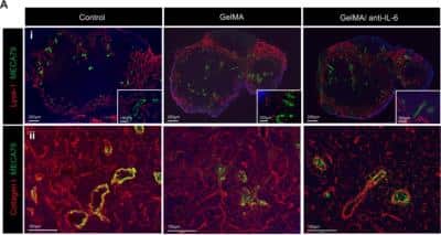 Immunohistochemistry: Peripheral Node Addressin Antibody (MECA-79) - Non-Recombinant Monoclonal [NB100-77673] - Local release of anti-IL-6 from IMB suppresses LN fibrosis. The skin allografts were harvested at 7 days post-transplantation. (A-i) Lymphatic vessel expansion (Lyve-1+) and HEV elongation (MECA79+) were similar between all groups. (A-ii,iii) Dense staining of collagen I was seen in DLNs harvested from control and GelMA group compared to those from GelMA/anti-IL-6 group. (representative images from 4 different mice per group). Image collected and cropped by CiteAb from the following publication (//www.nature.com/articles/s41598-019-42349-w), licensed under a CC-BY license.