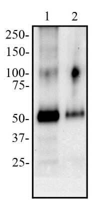 Western Blot: Peripheral Node Addressin Antibody (MECA-79) - Non-Recombinant Monoclonal [NB100-77673] - Total protein from Human tonsil (lane 1) and human lymph node (lane 2) was separated on a 7.5% gel by SDS-PAGE, transferred to PVDF membrane and blocked in 5% non-fat milk in TBST. The membrane was probed with 2 ug/mL anti-PNAd in 1% milk, and detected with an anti-rat IgM HRP conjugated secondary antibody using chemiluminescence.