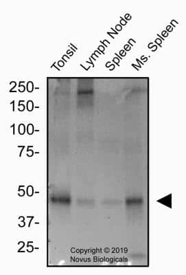 Western Blot: Peripheral Node Addressin Antibody (MECA-79R) [NBP2-78792] - Total protein from human Tonsil, Lymph node, Spleen and mouse Spleen was separated on a 7.5% gel by SDS-PAGE, transferred to PVDF membrane and blocked in 5% non-fat milk in TBST. The membrane was probed with 2.0 ug/ml anti-PNAd in blocking buffer and detected with an anti-rat HRP secondary antibody using West Pico PLUS chemiluminescence detection reagent.