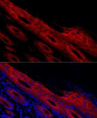 Immunocytochemistry/Immunofluorescence: Periplakin Antibody [NBP2-94787] - Analysis of human skin cells using PPL Rabbit pAb at dilution of 1:500 (40x lens). Blue: DAPI for nuclear staining.