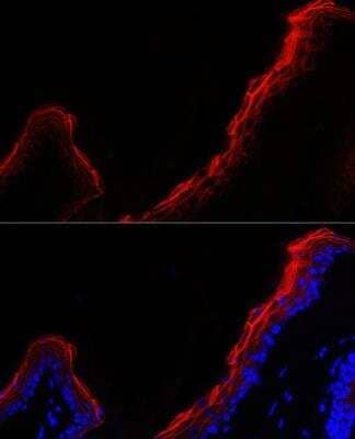 Immunocytochemistry/Immunofluorescence: Periplakin Antibody [NBP2-94787] - Analysis of mouse skin cells using PPL Rabbit pAb at dilution of 1:500 (40x lens). Blue: DAPI for nuclear staining.