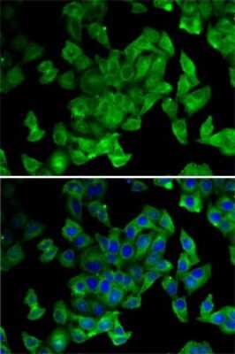 Immunocytochemistry/Immunofluorescence: Periplakin Antibody [NBP2-95228] - Analysis of MCF7 cells using Periplakin . Blue: DAPI for nuclear staining.