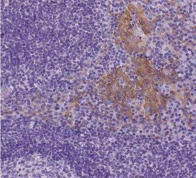 Immunohistochemistry-Paraffin: Periplakin Antibody [NBP2-13795] - Staining of human tonsil shows moderate membranous positivity in squamous epithelial cells.