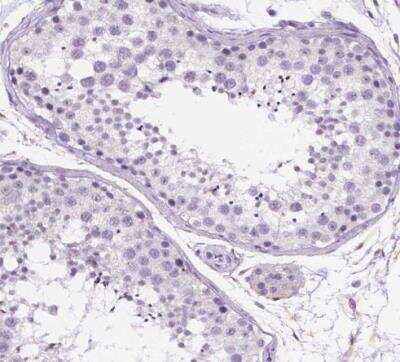 Immunohistochemistry-Paraffin: Periplakin Antibody [NBP2-13795] - Staining of human testis shows no positivity in cells in seminiferous ducts as expected.