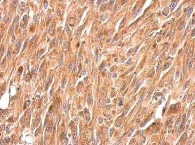 Immunohistochemistry-Paraffin: Periplakin Antibody [NBP2-19775] -  Paraffin-embedded U87 xenograft.  Periplakin antibody [N1N2], N-term  dilution: 1:500.