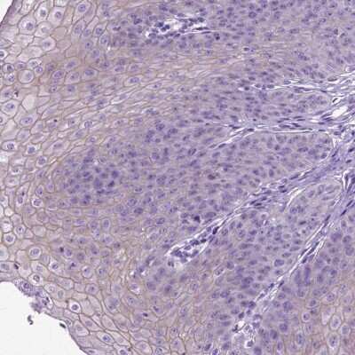 Immunohistochemistry-Paraffin: Periplakin Antibody [NBP2-49306] - Staining of human esophagus shows high expression.