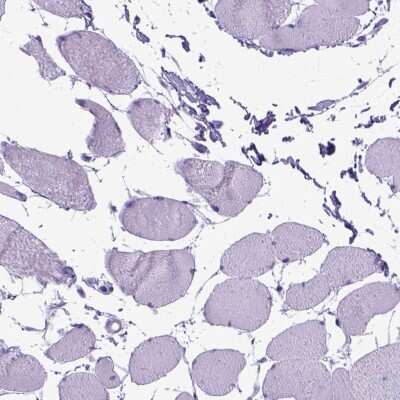 Immunohistochemistry-Paraffin: Periplakin Antibody [NBP2-49306] - Staining of human skeletal muscle shows low expression as expected.