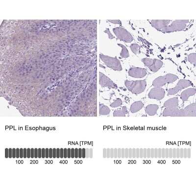 Immunohistochemistry-Paraffin: Periplakin Antibody [NBP2-49306] - Staining in human esophagus and skeletal muscle tissues using anti-PPL antibody. Corresponding PPL RNA-seq data are presented for the same tissues.