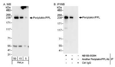 <b>Independent Antibodies Validation and Biological Strategies Validation.</b>Western Blot: Periplakin Antibody [NB100-55264] - Detection of Human Periplakin/PPL on HeLa whole cell lysate using NB100-55264. Periplakin/PPL was also immunoprecipitated by another rabbit anti-Periplakin/PPL antibody.