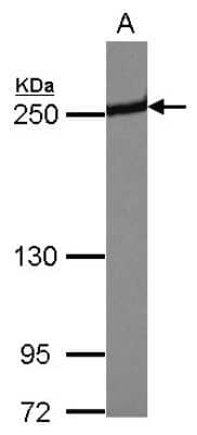 Western Blot: Periplakin Antibody [NBP2-19775] - Sample (30 ug of whole cell lysate) A: U87-MG 5% SDS PAGE gel, diluted at 1:5000.