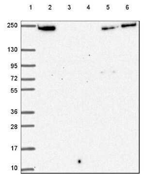 <b>Orthogonal Strategies Validation. </b>Western Blot: Periplakin Antibody [NBP2-49306] - Lane 1: Marker [kDa] 250, 130, 95, 72, 55, 36, 28, 17, 10Lane 2: Human cell line RT-4Lane 3: Human cell line U-251 MGLane 4: Human plasmaLane 5: Human Liver tissueLane 6: Human Tonsil tissue