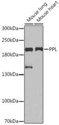 Western Blot: Periplakin Antibody [NBP2-94787] - Analysis of extracts of various cell lines, using Periplakin antibody at 1:1000 dilution. Secondary antibody: HRP Goat Anti-Rabbit IgG (H+L) at 1:10000 dilution. Lysates/proteins: 25ug per lane. Blocking buffer: 3% nonfat dry milk in TBST.Detection: ECL Basic Kit. Exposure time: 30s.