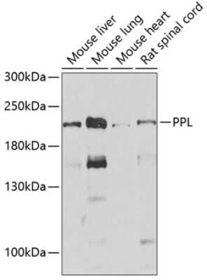 Western Blot: Periplakin Antibody [NBP2-95228] - Analysis of extracts of various cell lines, using Periplakin . Exposure time: 30s.