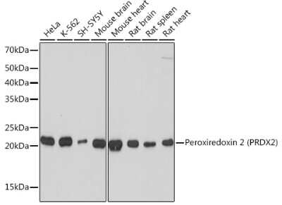 Western Blot: Peroxiredoxin 2 Antibody (1U9L9) [NBP3-16374] - Western blot analysis of extracts of various cell lines, using Peroxiredoxin 2 (PRDX2) Rabbit mAb (NBP3-16374) at 1:1000 dilution. Secondary antibody: HRP Goat Anti-Rabbit IgG (H+L) at 1:10000 dilution. Lysates/proteins: 25ug per lane. Blocking buffer: 3% nonfat dry milk in TBST. Detection: ECL Basic Kit. Exposure time: 1s.