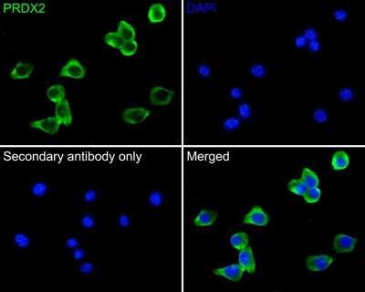 Immunocytochemistry/Immunofluorescence: Peroxiredoxin 2 Antibody (7F4) [NBP2-75614] - Analysis of PC-3 cells labeling PRDX2 with Mouse anti-Peroxiredoxin 2 antibody at 1/50 dilution. Cells were fixed in 4% paraformaldehyde for 30 minutes, permeabilized with 0.1% Triton X-100 in PBS for 15 minutes, and then blocked with 2% BSA for 30 minutes at room temperature. Cells were then incubated with Mouse anti-Peroxiredoxin 2 antibody at 1/100 dilution in 2% BSA overnight at 4 . Goat Anti-Mouse IgG H&L (iFluor(TM) 488) was used as the secondary antibody at 1/1,000 dilution. PBS instead of the primary antibody was used as the secondary antibody only control. Nuclear DNA was labelled in blue with DAPI.