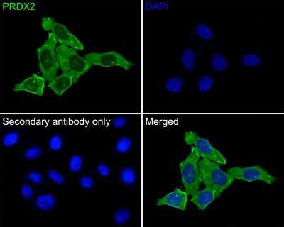 Immunocytochemistry/Immunofluorescence: Peroxiredoxin 2 Antibody (7F4) [NBP2-75614] - Analysis of HepG2 cells labeling PRDX2 with Mouse anti-Peroxiredoxin 2 antibody at 1/50 dilution. Cells were fixed in 4% paraformaldehyde for 30 minutes, permeabilized with 0.1% Triton X-100 in PBS for 15 minutes, and then blocked with 2% BSA for 30 minutes at room temperature. Cells were then incubated with Mouse anti-Peroxiredoxin 2 antibody at 1/100 dilution in 2% BSA overnight at 4 . Goat Anti-Mouse IgG H&L (iFluor(TM) 488) was used as the secondary antibody at 1/1,000 dilution. PBS instead of the primary antibody was used as the secondary antibody only control. Nuclear DNA was labelled in blue with DAPI.