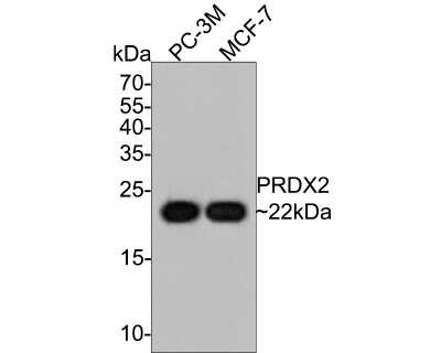 Western Blot: Peroxiredoxin 2 Antibody (7F4) [NBP2-75614] - Analysis of Peroxiredoxin 2 on different lysates with Mouse anti-Peroxiredoxin 2 antibody at 1/5,000 dilution. Lane 1: PC-3M cell lysate Lane 2: MCF-7 cell lysate Lysates/proteins at 10 ug/Lane. Predicted band size: 22 kDa Observed band size: 22 kDa Exposure time: 5 minutes; 15% SDS-PAGE gel. Proteins were transferred to a PVDF membrane and blocked with 5% NFDM/TBST for 1 hour at room temperature. The primary antibody at 1/5,000 dilution was used in 5% NFDM/TBST at room temperature for 2 hours. Goat Anti-Mouse IgG - HRP Secondary Antibody at 1:100,000 dilution was used for 1 hour at room temperature.