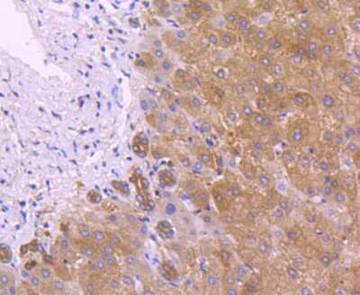 Immunohistochemistry-Paraffin: Peroxiredoxin 2 Antibody (JJ090-3) [NBP2-67887] - Analysis of paraffin-embedded human liver tissue using anti-Peroxiredoxin 2 antibody. Counter stained with hematoxylin.