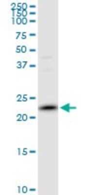 Western Blot: Peroxiredoxin 2 Antibody [H00007001-B02P] - Analysis of PRDX2 expression in HepG2.