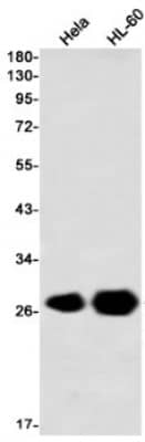 Western Blot: Peroxiredoxin 3 Antibody (S07-3I3) [NBP3-19906] - Western blot detection of Peroxiredoxin 3 in Hela, HL-60, using NBP3-19906 (1:1000 diluted)