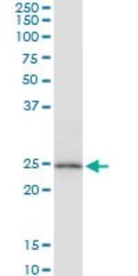 Western Blot: Peroxiredoxin 3 Antibody [H00010935-B01P] - Analysis of PRDX3 expression in A-431.