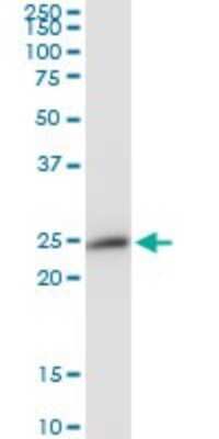 Western Blot: Peroxiredoxin 3 Antibody [H00010935-B01P] - Analysis of PRDX3 expression in human kidney.