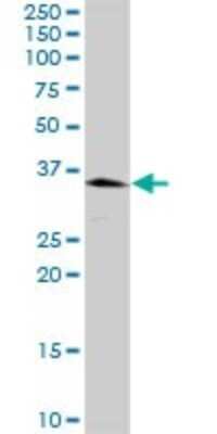 Western Blot: Peroxiredoxin 3 Antibody [H00010935-D01P] - Analysis of PRDX3 expression in mouse spleen.