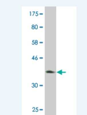 Western Blot: Peroxiredoxin 4 Antibody (4C3) [H00010549-M03] - Detection against Immunogen (36.74 KDa) .