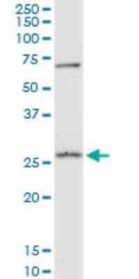 Western Blot: Peroxiredoxin 4 Antibody [H00010549-B01P] - Analysis of PRDX4 expression in HepG2.