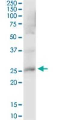 Western Blot: Peroxiredoxin 4 Antibody [H00010549-B01P] - Analysis of PRDX4 expression in human kidney.