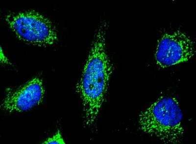 Immunocytochemistry/Immunofluorescence: Peroxiredoxin 5 Antibody (002) [NBP2-89862] - Staining of PRDX5 in Hela cells. Cells were fixed with 4% PFA, blocked with 10% serum, and incubated with rabbit anti-human PRDX5 monoclonal antibody (1:60) at 4c overnight. Then cells were stained with the Alexa Fluor(R) 488-conjugated Goat Anti-rabbit IgG secondary antibody (green) and counterstained with DAPI (blue).