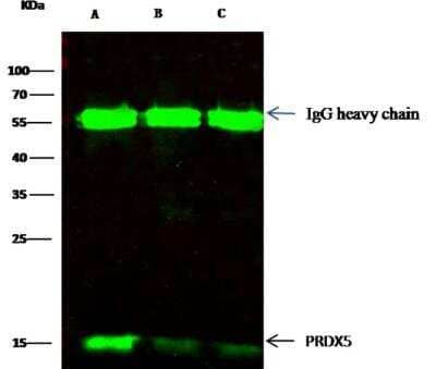 Immunoprecipitation: Peroxiredoxin 5 Antibody (002) [NBP2-89862] - Lane A:0.5 mg Hela Whole Cell Lysate Lane B:0.5 mg Jurkat Whole Cell LysateLane C:0.5 mg 293T Whole Cell Lysate 2 uL anti-PRDX5 rabbit monoclonal antibody and 15 ul of 50 % Protein G agarose. Primary antibody:Anti-PRDX5 rabbit monoclonal antibody,at 1:500 dilution Secondary antibody:Dylight 800-labeled antibody to rabbit IgG (H+L), at 1:5000 dilution  Developed using the odssey technique. Performed under reducing conditions.Predicted band size: 22 kDa Observed band size: 22 kDa