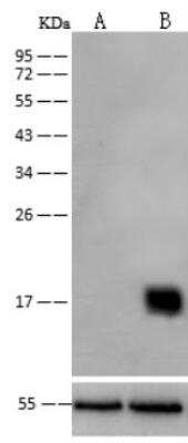 <b>Genetic Strategies Validation. </b>Knockout Validated: Peroxiredoxin 5 Antibody (002) [NBP2-89862] - Lane A: PRDX5 konckout Hela Whole Cell Lysate Lane B: Hela Whole Cell LysateLysates/proteins at 30 ug per lane. Secondary Goat Anti-Rabbit IgG (H+L)/HRP at 1/10000 dilution. Developed using the ECL technique. Performed under reducing conditions. Predicted band size:22 kDa Observed band size:15 kDa