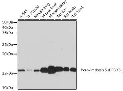 Western Blot: Peroxiredoxin 5 Antibody (5E10D3) [NBP3-16300] - Western blot analysis of extracts of various cell lines, using Peroxiredoxin 5 (PRDX5) Rabbit mAb (NBP3-16300) at 1:1000 dilution. Secondary antibody: HRP Goat Anti-Rabbit IgG (H+L) at 1:10148 dilution. Lysates/proteins: 25ug per lane. Blocking buffer: 3% nonfat dry milk in TBST. Detection: ECL Basic Kit. Exposure time: 30s.