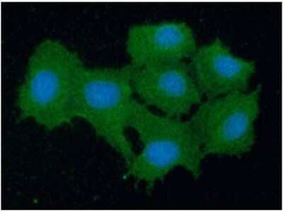 Immunocytochemistry/Immunofluorescence: Peroxiredoxin 5 Antibody (6A10) [NBP2-59388] - Analysis of PRDX5 in Hep3B cells line, stained with DAPI (Blue) for nucleus staining and monoclonal anti-human   PRDX5 antibody (1:100) with goat anti-mouse IgG-Alexa fluor 488 conjugate (Green).