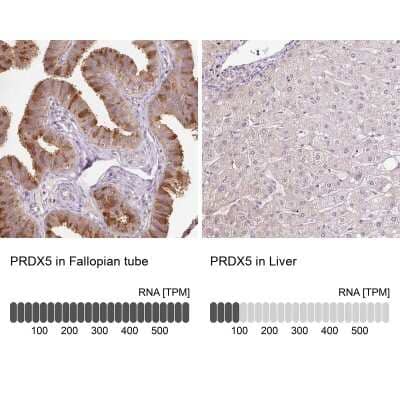 Immunohistochemistry-Paraffin: Peroxiredoxin 5 Antibody [NBP2-38371] - Staining in human fallopian tube and liver tissues using anti-PRDX5 antibody. Corresponding PRDX5 RNA-seq data are presented for the same tissues.