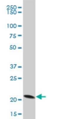 Western Blot: Peroxiredoxin 5 Antibody [H00025824-A01] - Analysis of PRDX5 expression in HL-60 (Cat # L014V1).