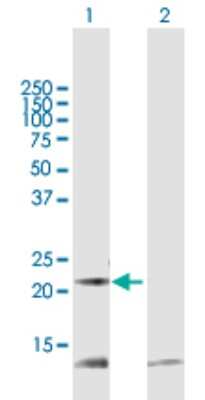 Western Blot: Peroxiredoxin 5 Antibody [H00025824-B01P] - Analysis of PRDX5 expression in transfected 293T cell line by PRDX5 polyclonal antibody.  Lane 1: PRDX5 transfected lysate(23.54 KDa). Lane 2: Non-transfected lysate.