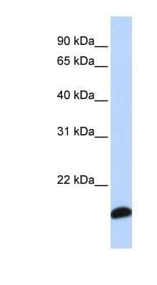 Western Blot: Peroxiredoxin 5 Antibody [NBP1-58348] - Titration: 0.2-1 ug/ml, Positive Control: Human Lung.