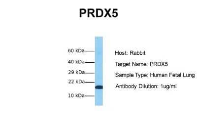 Western Blot: Peroxiredoxin 5 Antibody [NBP1-58348] - Sample Tissue: Human Fetal Lung Antibody Dilution: 1.0 ug/ml