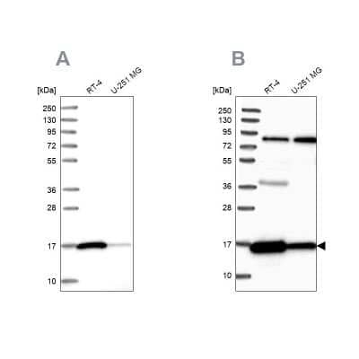 <b>Independent Antibodies Validation and Orthogonal Strategies Validation.</b>Western Blot: Peroxiredoxin 5 Antibody [NBP2-38370] - Analysis using Anti-PRDX5 antibody NBP2-38370 (A) shows similar pattern to independent antibody NBP2-38371 (B).