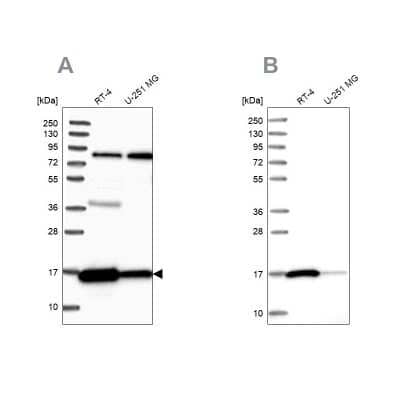 <b>Independent Antibodies Validation and Orthogonal Strategies Validation.</b>Western Blot: Peroxiredoxin 5 Antibody [NBP2-38371] - Analysis using Anti-PRDX5 antibody NBP2-38371 (A) shows similar pattern to independent antibody NBP2-38370 (B).