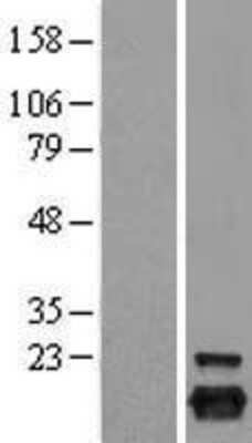 Western Blot: Peroxiredoxin 5 Overexpression Lysate (Adult Normal) [NBL1-14742] Left-Empty vector transfected control cell lysate (HEK293 cell lysate); Right -Over-expression Lysate for Peroxiredoxin 5.