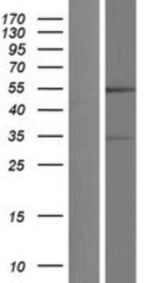 Western Blot GFR alpha-4/GDNF R alpha-4/Persephin receptor Overexpression Lysate