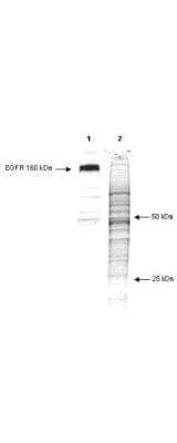 Western Blot: Phospho-Tyrosine Antibody (13F9) [NB600-907] - Lane 1: phosphorylated EGFR in an A431 cell lysate. Lane 2: total protein in the unstimulated A431 cells lysate after coomassie staining. Load: 10 ug per lane. Primary antibody: phosphotyrosine antibody at 1:1000 for 1 hr at RT. Secondary antibody: IRDye800 Conjugated Goat-a-Mouse IgG [H&L] diluted 1:2,500 for 30' at room temperature. Block: 5% BLOTTO overnight at 4C. Other band(s): phosphotyrosine splice variants and isoforms.