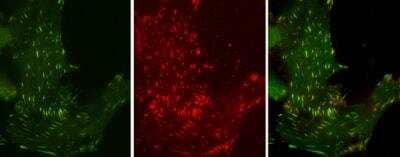 <b>Biological Strategies Validation. </b>Immunocytochemistry/Immunofluorescence: Phospho-Tyrosine Antibody (21) [NBP2-42911] - Analysis of Sample: MDA-MB-231 cells were fixed in 4% paraformaldehyde at RT for 15 min. Green: Phosphotyrosine protein stained by Phosphotyrosine antibody [0021] diluted at 1:50. Red: paxillin, a cytoskeleton marker, stained by Paxillin antibody diluted at 1:100.